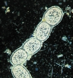 thiomargarita namibiensis